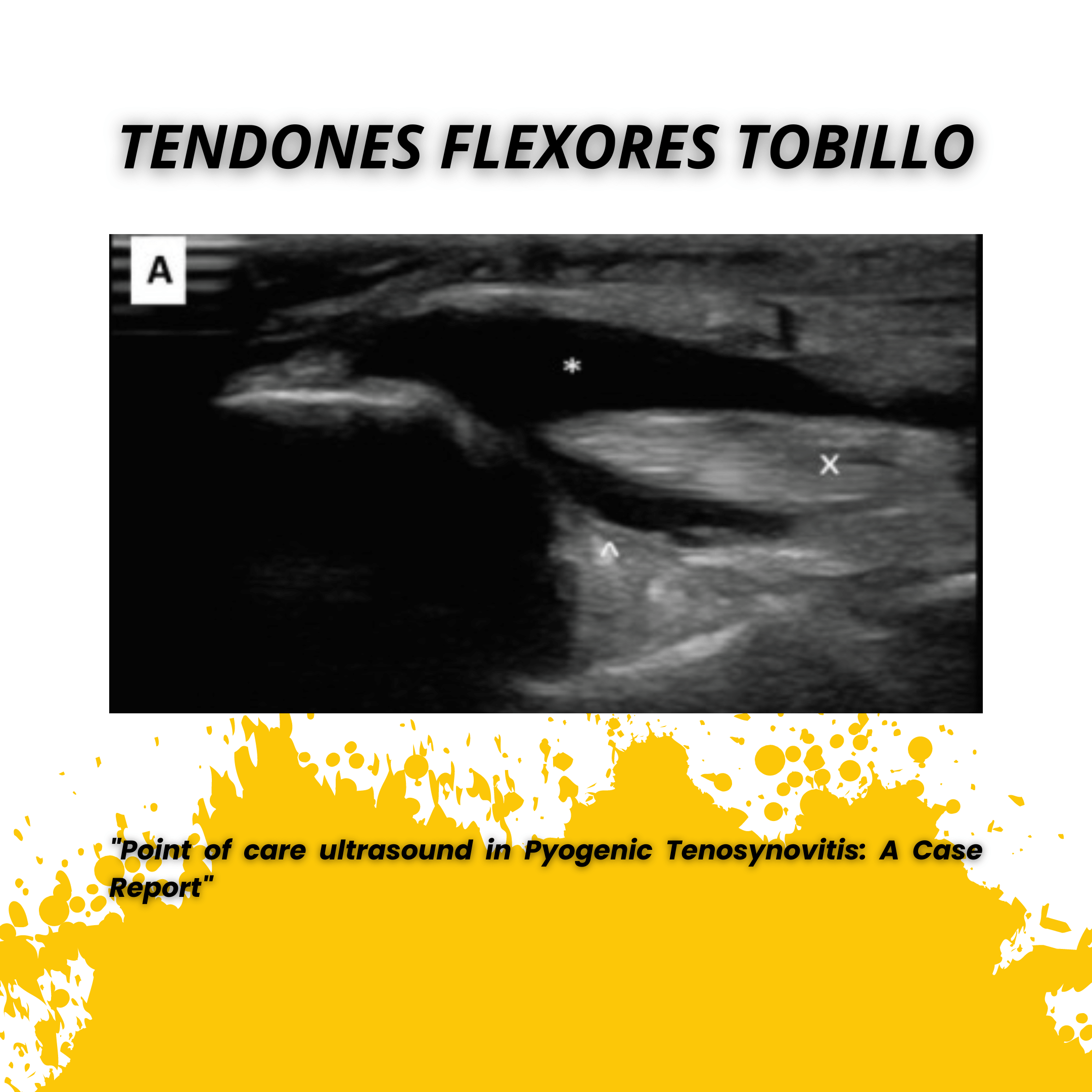 Tendones flexores tobillo tempo formacion.png